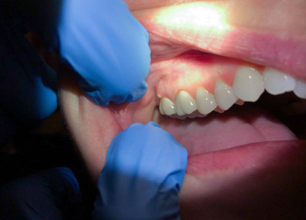 Best Emergency Gum Pain Relief  in Madras, OR